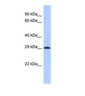 ACSF3 Antibody - Western blot of Human MCF7. ACSF3 antibody dilution 1.0 ug/ml.  This image was taken for the unconjugated form of this product. Other forms have not been tested.