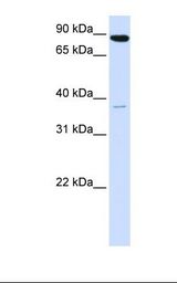 ACSL3 Antibody - 293T cell lysate. Antibody concentration: 1.0 ug/ml. Gel concentration: 12%.  This image was taken for the unconjugated form of this product. Other forms have not been tested.