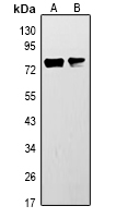 ACSL3 Antibody - Western blot analysis of ACSL3 expression in Hela (A), mouse kidney (B) whole cell lysates.