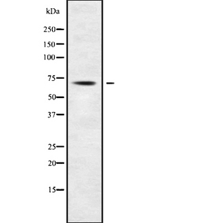 ACSL3 Antibody - Western blot analysis of ACSL3 using Jurkat whole cells lysates