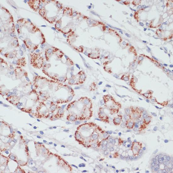 ACSL3 Antibody - Immunohistochemistry of paraffin-embedded Human stomach using ACSL3 Polyclonal Antibody at dilution of 1:100 (40x lens).