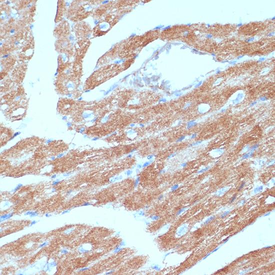 ACSL3 Antibody - Immunohistochemistry of paraffin-embedded Mouse heart using ACSL3 Polyclonal Antibody at dilution of 1:100 (40x lens).