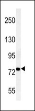 ACSL4 / FACL4 Antibody - FACL4-E251 western blot of HepG2 cell line lysates (35 ug/lane). The FACL4 antibody detected the FACL4 protein (arrow).
