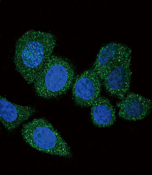 ACSL4 / FACL4 Antibody - Confocal immunofluorescence of ACSL4 (FACL4) Antibody with HeLa cell followed by Alexa Fluor 488-conjugated goat anti-rabbit lgG (green). DAPI was used to stain the cell nuclear (blue).