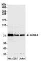 ACSL4 / FACL4 Antibody - Detection of human ACSL4 by western blot. Samples: Whole cell lysate (50 µg) from HeLa, HEK293T, and Jurkat cells prepared using NETN lysis buffer. Antibody: Affinity purified rabbit anti-ACSL4 antibody used for WB at 0.1 µg/ml. Detection: Chemiluminescence with an exposure time of 30 seconds.
