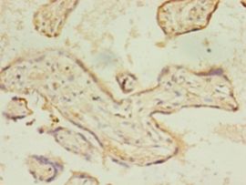 ACSL4 / FACL4 Antibody - Immunohistochemistry of paraffin-embedded human placenta tissue using antibody at 1:100 dilution.  This image was taken for the unconjugated form of this product. Other forms have not been tested.