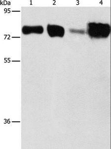 ACSL4 / FACL4 Antibody - Western blot analysis of Hepg2 and HeLa cell, human fetal kidney and liver tissue, using ACSL4 Polyclonal Antibody at dilution of 1:650.