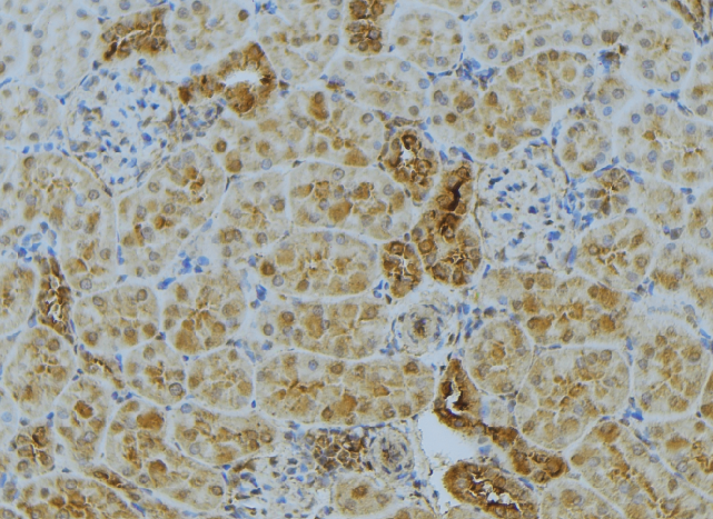 ACSL4 / FACL4 Antibody - 1:100 staining mouse kidney tissue by IHC-P. The sample was formaldehyde fixed and a heat mediated antigen retrieval step in citrate buffer was performed. The sample was then blocked and incubated with the antibody for 1.5 hours at 22°C. An HRP conjugated goat anti-rabbit antibody was used as the secondary.