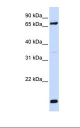 ACSL4 / FACL4 Antibody - Hela cell lysate. Antibody concentration: 1.0 ug/ml. Gel concentration: 12%.  This image was taken for the unconjugated form of this product. Other forms have not been tested.