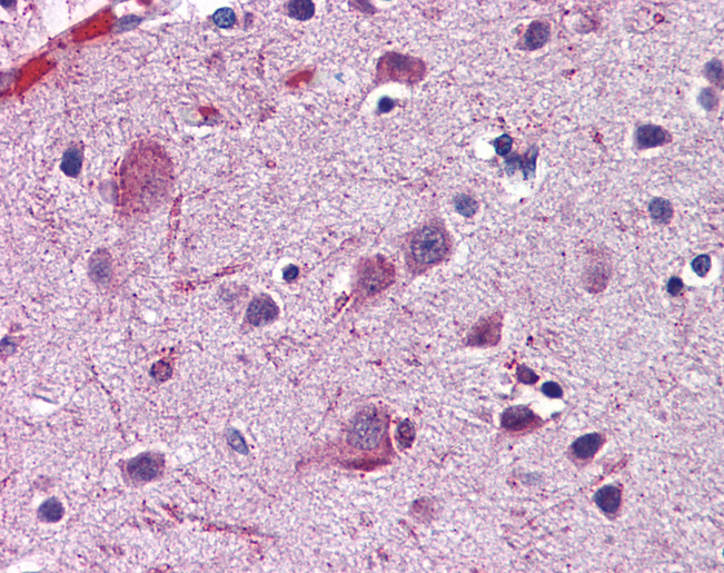 ACSL4 / FACL4 Antibody - Anti-ACSL4 antibody IHC of human brain, cortex. Immunohistochemistry of formalin-fixed, paraffin-embedded tissue after heat-induced antigen retrieval. Antibody concentration 5 ug/ml.  This image was taken for the unconjugated form of this product. Other forms have not been tested.