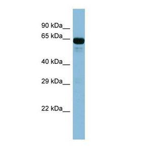 ACSL6 Antibody - Western blot of Human Fetal Kidney. ACSL6 antibody dilution 1.0 ug/ml.  This image was taken for the unconjugated form of this product. Other forms have not been tested.