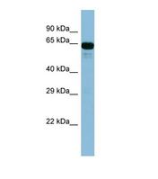 ACSL6 Antibody - Western blot of Human Fetal Kidney. ACSL6 antibody dilution 1.0 ug/ml.  This image was taken for the unconjugated form of this product. Other forms have not been tested.