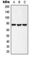 ACSL6 Antibody - Western blot analysis of ACSL6 expression in HepG2 (A); mouse brain (B); rat brain (C) whole cell lysates.
