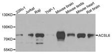 ACSL6 Antibody - Western blot analysis of extracts of various cells.