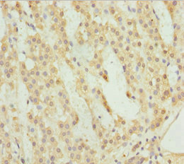 ACSL6 Antibody - Immunohistochemistry of paraffin-embedded human adrenal gland tissue at dilution 1:100