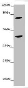 ACSL6 Antibody - Western blot All Lanes:ACSL6 antibody at 4.25 ug/ml + Mouse liver tissue Secondary Goat polyclonal to rabbit IgG at 1/10000 dilution Predicted band size: 78,81,75,77,80,70 kDa Observed band size: 78,42 kDa