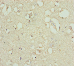 ACSL6 Antibody - Immunohistochemistry of paraffin-embedded human brain tissue at dilution 1:100