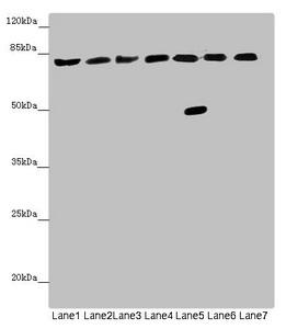 ACSL6 Antibody - Western blot All Lanes: ACSL6 antibody at 4.64 ug/ml Lane 1: Mouse liver tissue Lane 2: Mouse heart tissue Lane 3: Mouse brain tissue Lane 4: Mouse gonadal tissue Lane 5: Jurkat whole cell lysate Lane 6: Raji whole cell lysate Lane 7: K562 whole cell lysate Secondary Goat polyclonal to rabbit IgG at 1/10000 dilution Predicted band size: 78,81,75,77,80,70 kDa Observed band size: 78,42 kDa