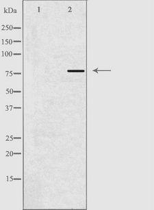 ACSL6 Antibody - Western blot analysis of extracts of COLO cells using ACSL6 antibody. The lane on the left is treated with the antigen-specific peptide.