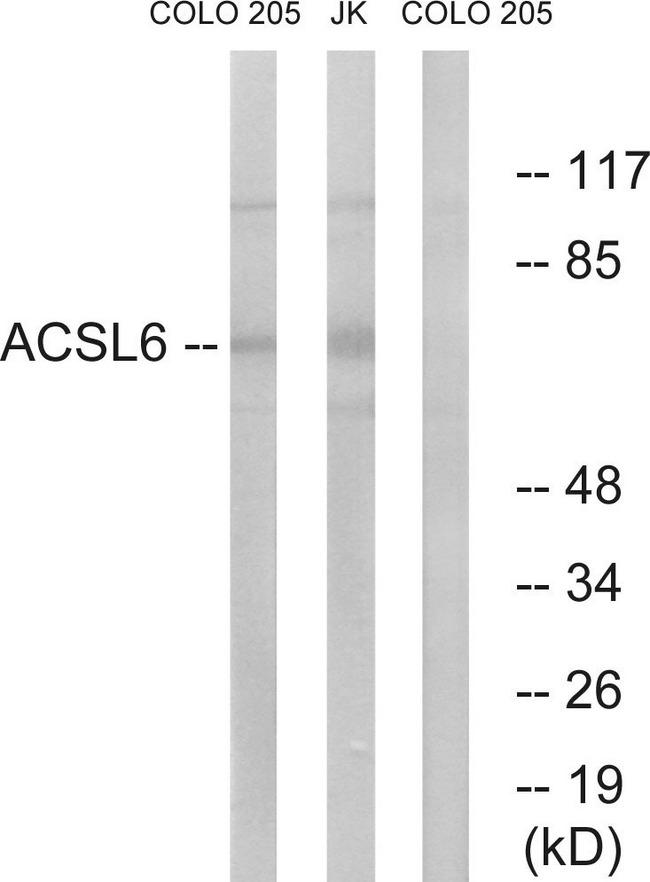 ACSL6 Antibody - Western blot analysis of extracts from COLO cells and Jurkat cells, using ACSL6 antibody.