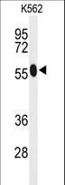 ACSM1 Antibody - Western blot of ACSM1 Antibody in K562 cell line lysates (35 ug/lane). ACSM1 (arrow) was detected using the purified antibody.