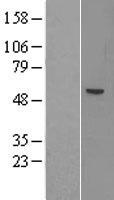 ACSM1 Protein - Western validation with an anti-DDK antibody * L: Control HEK293 lysate R: Over-expression lysate