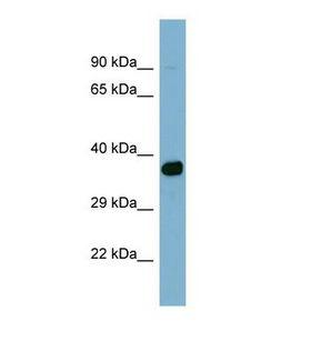 ACSM2A / MACS2 Antibody - Western blot of Human NCI-H226 Whole cell . ACSM2A antibody dilution 1.0 ug/ml.  This image was taken for the unconjugated form of this product. Other forms have not been tested.