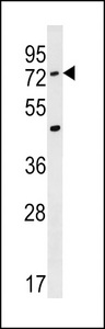ACSM2A / MACS2 Antibody - ACSM2A Antibody western blot of A549 cell line lysates (35 ug/lane). The ACSM2A antibody detected the ACSM2A protein (arrow).