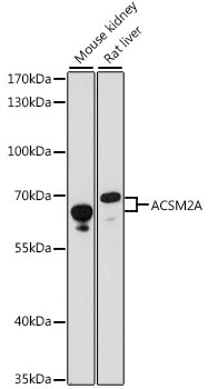 ACSM2A / MACS2 Antibody - Western blot analysis of extracts of various cell lines, using ACSM2A antibody at 1:1000 dilution. The secondary antibody used was an HRP Goat Anti-Rabbit IgG (H+L) at 1:10000 dilution. Lysates were loaded 25ug per lane and 3% nonfat dry milk in TBST was used for blocking. An ECL Kit was used for detection and the exposure time was 60s.