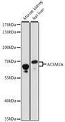 ACSM2A / MACS2 Antibody - Western blot analysis of extracts of various cell lines, using ACSM2A antibody at 1:1000 dilution. The secondary antibody used was an HRP Goat Anti-Rabbit IgG (H+L) at 1:10000 dilution. Lysates were loaded 25ug per lane and 3% nonfat dry milk in TBST was used for blocking. An ECL Kit was used for detection and the exposure time was 60s.