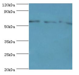 ACSM3 / SAH Antibody - Western blot. All lanes: Acyl-coenzyme A synthetase ACSM3, mitochondrial antibody at 10 ug/ml. Lane 1: 293T whole cell lysate. Lane 2: mouse kidney tissue. Lane 3: A431 whole cell lysate. secondary Goat polyclonal to rabbit at 1:10000 dilution. Predicted band size: 66 kDa. Observed band size: 66 kDa.