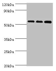 ACSM3 / SAH Antibody - Western blot All lanes: Acyl-coenzyme A synthetase ACSM3, mitochondrial antibody at 10µg/ml Lane 1: 293T whole cell lysate Lane 2: Mouse kidney tissue Lane 3: A431 whole cell lysate Secondary Goat polyclonal to rabbit IgG at 1/10000 dilution Predicted band size: 67, 50 kDa Observed band size: 67 kDa