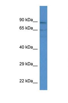ACSM3 / SAH Antibody - ACSM3 antibody Western blot of Placenta lysate. Antibody concentration 1 ug/ml.  This image was taken for the unconjugated form of this product. Other forms have not been tested.