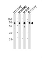 ACSM5 / MACS3 Antibody - Western blot of lysates from human kidney, mouse kidney, mouse liver, rat kidney tissue lysate (from left to right), using ACSM5 antibody diluted at 1:1000 at each lane. A goat anti-rabbit IgG H&L (HRP) at 1:10000 dilution was used as the secondary antibody. Lysates at 20 ug per lane.