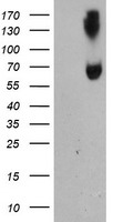 ACSM5 / MACS3 Antibody - HEK293T cells were transfected with the pCMV6-ENTRY control (Left lane) or pCMV6-ENTRY ACSM5 (Right lane) cDNA for 48 hrs and lysed. Equivalent amounts of cell lysates (5 ug per lane) were separated by SDS-PAGE and immunoblotted with anti-ACSM5.