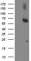ACSM5 / MACS3 Antibody - HEK293T cells were transfected with the pCMV6-ENTRY control (Left lane) or pCMV6-ENTRY ACSM5 (Right lane) cDNA for 48 hrs and lysed. Equivalent amounts of cell lysates (5 ug per lane) were separated by SDS-PAGE and immunoblotted with anti-ACSM5.
