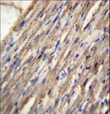 ACSM6 Antibody - C10orf129 Antibody immunohistochemistry of formalin-fixed and paraffin-embedded human heart tissue followed by peroxidase-conjugated secondary antibody and DAB staining.