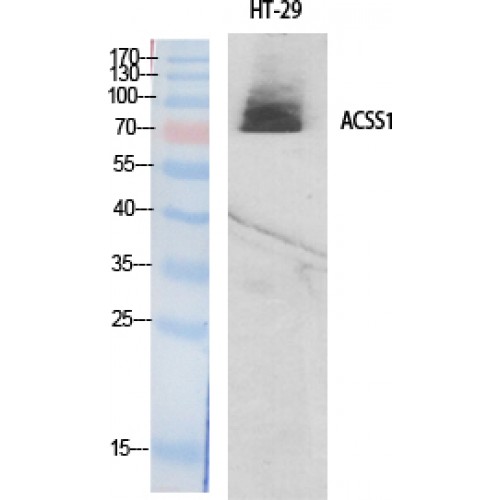 ACSS1 Antibody - Western blot of ACSS1 antibody
