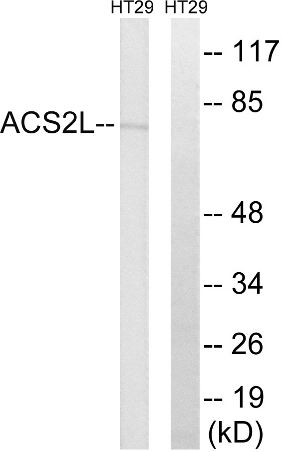 ACSS1 Antibody - Western blot analysis of lysates from HT-29 cells, using ACSS1 Antibody. The lane on the right is blocked with the synthesized peptide.