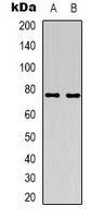 ACSS1 Antibody - Western blot analysis of ACSS1 expression in HT29 (A); Jurkat (B) whole cell lysates.