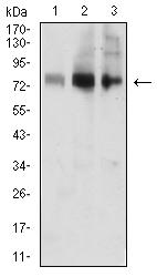 ACSS1 Antibody - Western blot analysis using ACSS1 mouse mAb against MOLT4 (1), Jurkat (2), and HL-60 (3) cell lysate.
