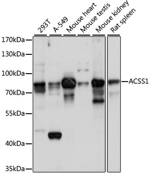 ACSS1 Antibody - Western blot analysis of extracts of various cell lines, using ACSS1 antibody at 1:1000 dilution. The secondary antibody used was an HRP Goat Anti-Rabbit IgG (H+L) at 1:10000 dilution. Lysates were loaded 25ug per lane and 3% nonfat dry milk in TBST was used for blocking. An ECL Kit was used for detection and the exposure time was 10s.