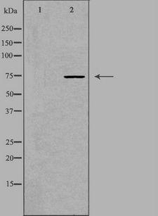 ACSS1 Antibody - Western blot analysis of extracts of HT29 cells using ACS2L antibody. The lane on the left is treated with the antigen-specific peptide.
