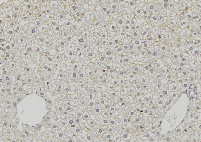 ACSS1 Antibody - 1:100 staining mouse liver tissue by IHC-P. The sample was formaldehyde fixed and a heat mediated antigen retrieval step in citrate buffer was performed. The sample was then blocked and incubated with the antibody for 1.5 hours at 22°C. An HRP conjugated goat anti-rabbit antibody was used as the secondary.