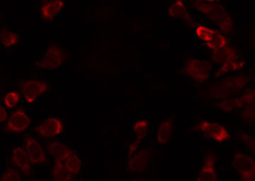 ACSS1 Antibody - Staining HT29 cells by IF/ICC. The samples were fixed with PFA and permeabilized in 0.1% Triton X-100, then blocked in 10% serum for 45 min at 25°C. The primary antibody was diluted at 1:200 and incubated with the sample for 1 hour at 37°C. An Alexa Fluor 594 conjugated goat anti-rabbit IgG (H+L) Ab, diluted at 1/600, was used as the secondary antibody.