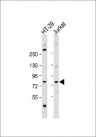 ACSS1 Antibody - All lanes: Anti-ACSS1 Antibody (N-Term) at 1:2000 dilution Lane 1: HT-29 whole cell lysate Lane 2: Jurkat whole cell lysate Lysates/proteins at 20 µg per lane. Secondary Goat Anti-Rabbit IgG, (H+L), Peroxidase conjugated at 1/10000 dilution. Predicted band size: 75 kDa Blocking/Dilution buffer: 5% NFDM/TBST.