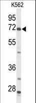 ACSS2 / ACAS2 Antibody - Western blot of ACSS2 Antibody in K562 cell line lysates (35 ug/lane). ACSS2 (arrow) was detected using the purified antibody.