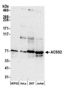 ACSS2 / ACAS2 Antibody - Detection of human ACSS2 by western blot. Samples: Whole cell lysate (50 µg) from Hep-G2, HeLa, HEK293T, and Jurkat cells prepared using NETN lysis buffer. Antibody: Affinity purified rabbit anti-ACSS2 antibody used for WB at 0.1 µg/ml. Detection: Chemiluminescence with an exposure time of 3 minutes.
