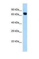ACSS2 / ACAS2 Antibody - ACSS2 antibody Western blot of Fetal Heart lysate. Antibody concentration 1 ug/ml.  This image was taken for the unconjugated form of this product. Other forms have not been tested.