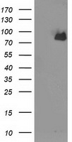 ACSS2 / ACAS2 Antibody - HEK293T cells were transfected with the pCMV6-ENTRY control (Left lane) or pCMV6-ENTRY ACSS2 (Right lane) cDNA for 48 hrs and lysed. Equivalent amounts of cell lysates (5 ug per lane) were separated by SDS-PAGE and immunoblotted with anti-ACSS2.